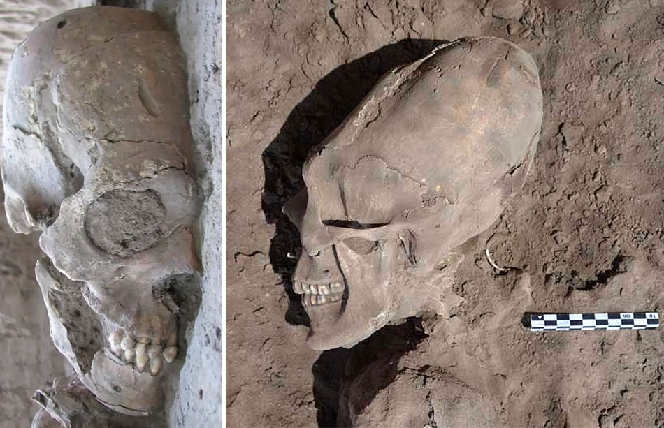 25 old skeletons were found in the village of Onavas ( North-West Mexico) in 2012. 13 of them had elongated skulls, 5 of which had strange teeth: pointy front teeth and flat canines